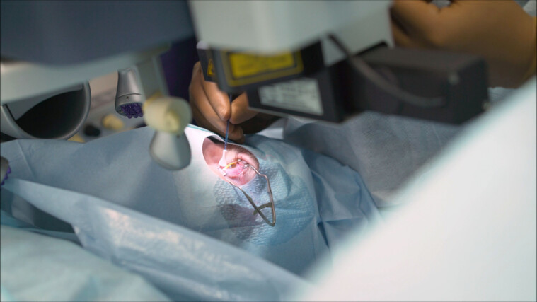 Lentes premium para cirugías oculares: Tratamientos y recuperación